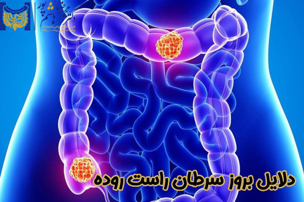 دلایل بروز سرطان راست روده