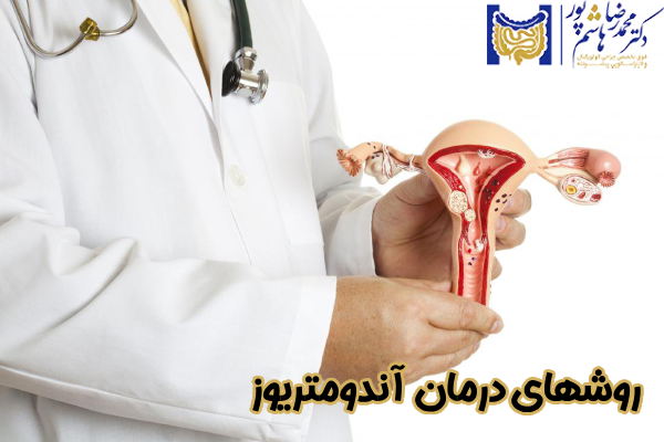 روشهای درمان آندومتریوز