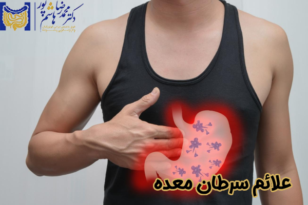 علائم سرطان معده