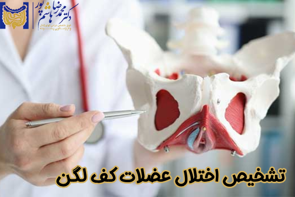 تشخیص اختلال عضلات کف لگن