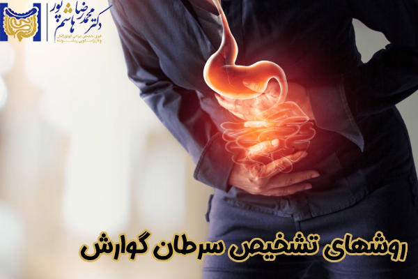 روشهای تشخیص سرطان گوارش