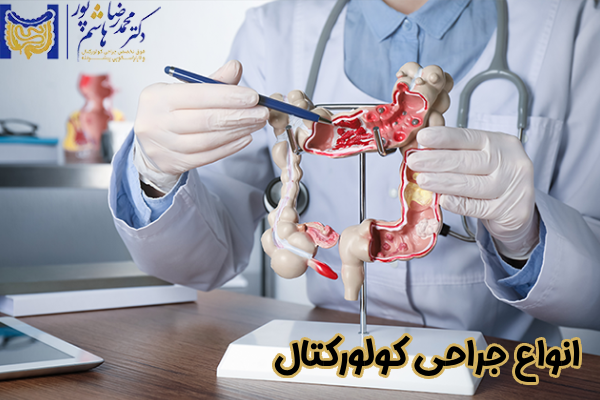 انواع جراحی کولورکتال
