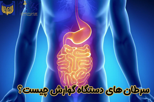 سرطان های دستگاه گوارش چیست؟