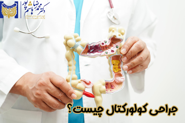 جراحی کولورکتال چیست
