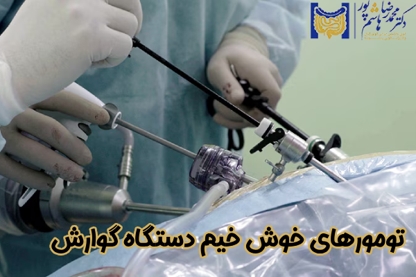 تومورهای خوش‌ خیم دستگاه گوارش