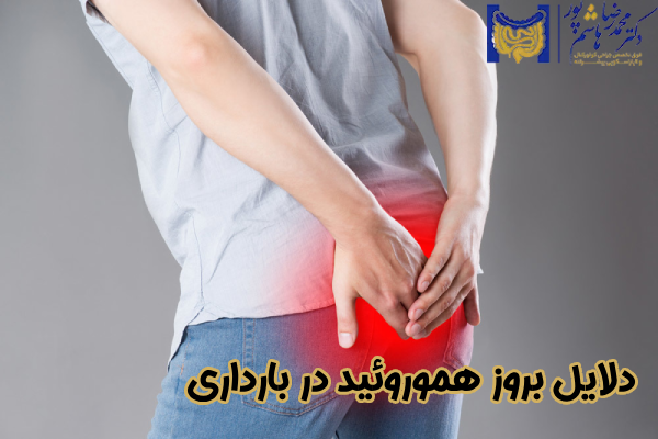 دلایل بروز هموروئید در بارداری