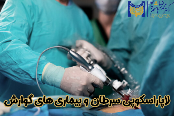 جراحی لاپاراسکوپی سرطان و بیماری گوارش