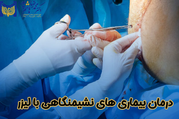 درمان بیماری های نشیمنگاهی با لیزر