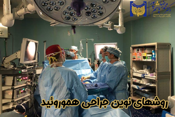 روشهای نوین جراحی هموروئید