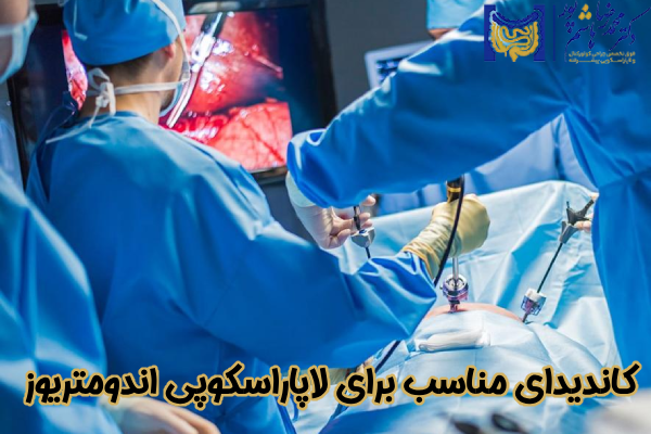 کاندیدای مناسب برای لاپاراسکوپی اندومتریوز