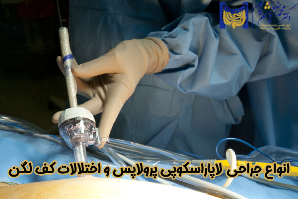 انواع جراحی لاپاراسکوپی پرولاپس و اختلالات کف لگن