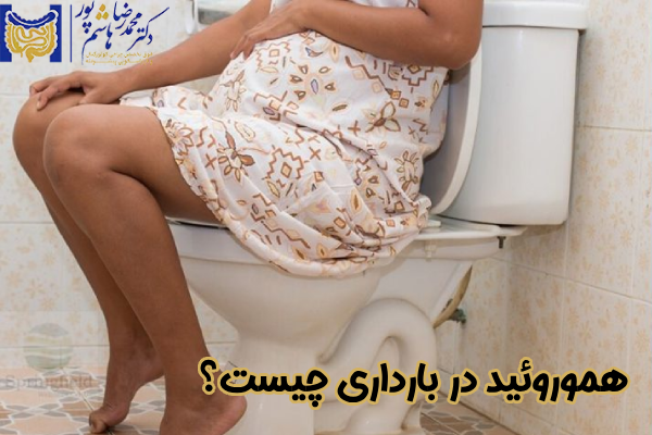 هموروئید در بارداری چیست؟