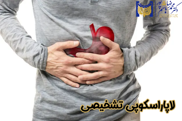 لاپاراسکوپی تشخیصی