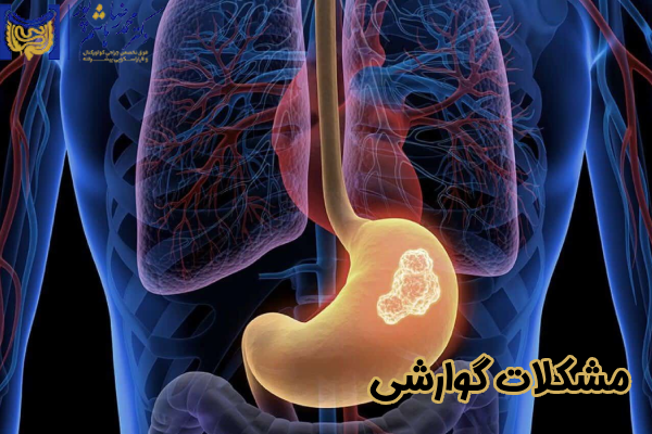 مشکلات گوارشی