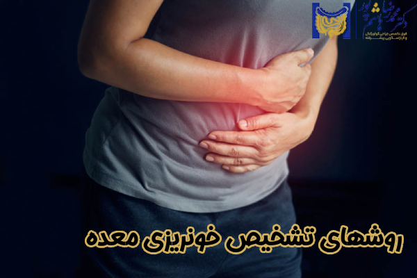 روشهای تشخیص خونریزی معده
