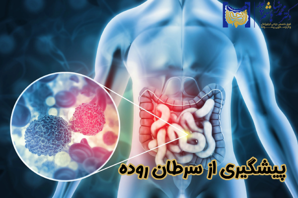 روشهای پیشگیری از سرطان روده