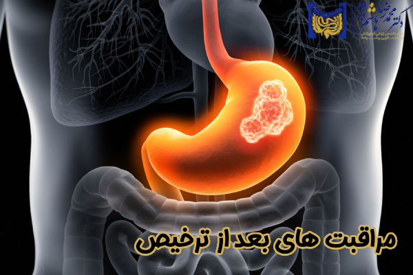 مراقبت‌ های بعد از ترخیص