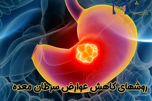 کاهش عوارض سرطان معده