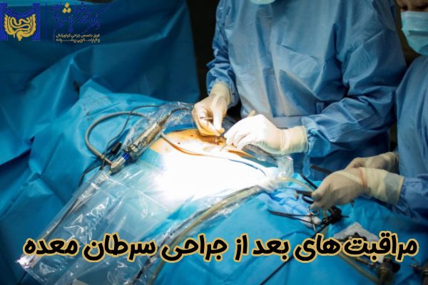 اقدامات بعد از جراحی سرطان معده