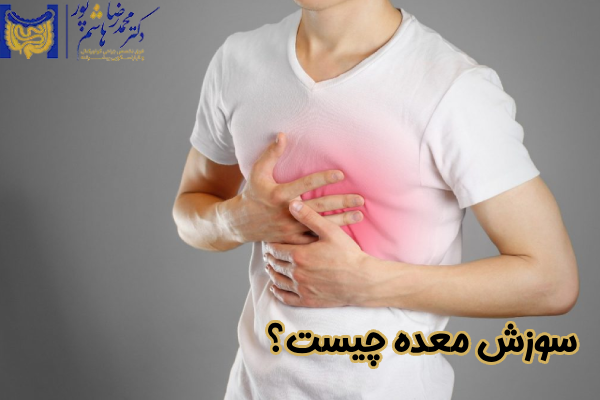 سوزش معده چیست
