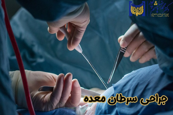 جراحی سرطان معده چیست