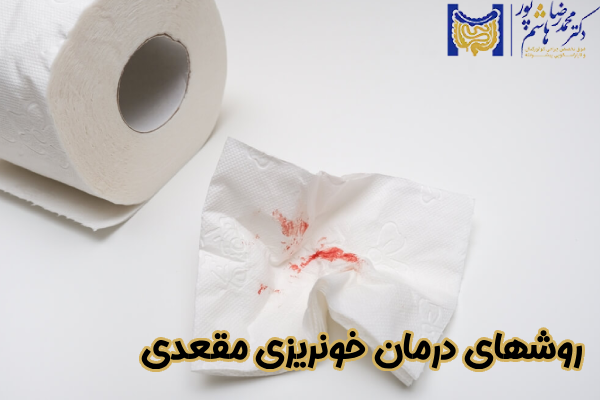 روشهای درمان خونریزی مقعدی