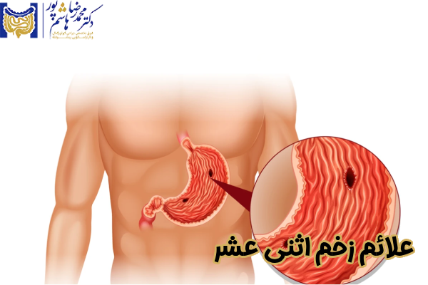 علائم زخم اثنی‌ عشر