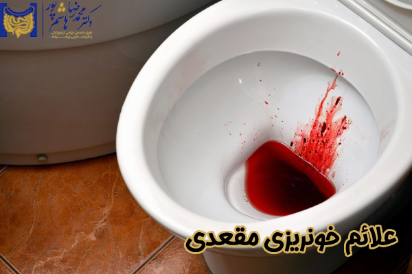 علائم خونریزی مقعدی