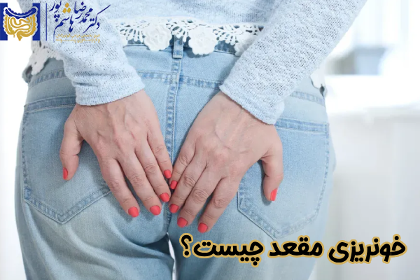 خونریزی مقعد چیست